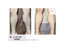 レア(Rea)の雰囲気（「メンズ脱毛◆脚」ずっと￥4000で通えます♪）