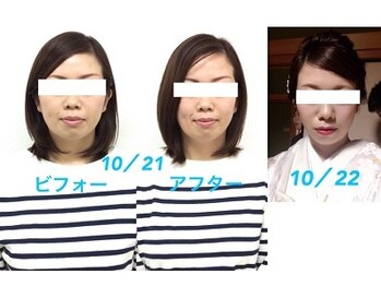 ビューティスタジオＫ/小顔矯正ビフォーアフター