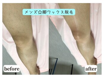 ジョエルワックス 沖縄コザ店(JOELLE WAX)/メンズ★脚ワックス脱毛