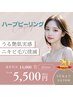 20周年記念★ニキビ毛穴ケア特化　美らハーブピーリング　5500円　