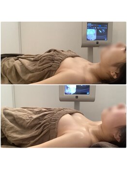 ボーレーヴ(beau reve)/ブライダル/バストアップ/痩身