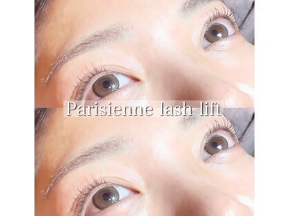 バルフィット(BALFIT)の写真