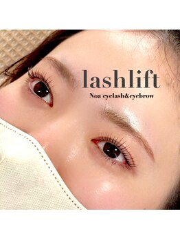 ノア(NOA)/《リッチケアコース》がおすすめ