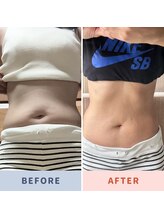 ケンビラク(Kenbiraku 健美楽)/お得意様カーヴィー炭酸お腹30日