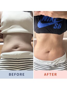 ケンビラク(Kenbiraku 健美楽)/お得意様カーヴィー炭酸お腹30日