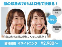 ホワイトニングカフェ 北九州小倉店(WhiteningCafe)