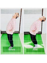 門前仲町イエティ鍼灸整骨院（旧：イエティ鍼灸整骨院）/慢性腰痛で血流が悪い腰を改善☆