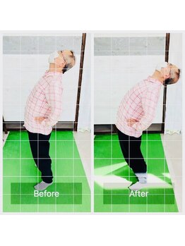 門前仲町イエティ鍼灸整骨院（旧：イエティ鍼灸整骨院）/慢性腰痛で血流が悪い腰を改善☆