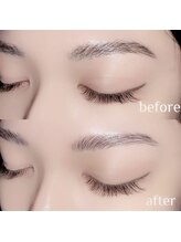 眉毛の長ささえあれば誰でも施術可能◎