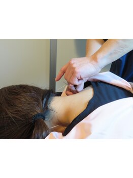 鍼灸施術を受けたい