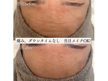 フィエルテ(Fielte)の写真