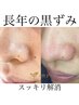 10年以上悩んでる黒ずみに【ごっそり毛穴角栓除去＋水素洗浄吸引】全顔徹底◎