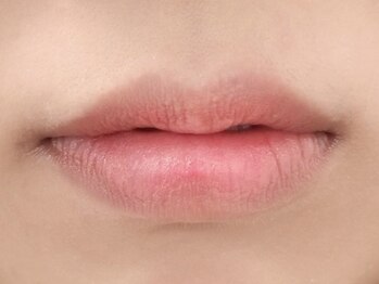 ラッシュ 広島店(RLASH)の写真/【ローマピンク導入サロン】韓国美容発の最新技術!!唇の黒ずみ・色むらを改善して本来のトーンに♪