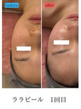 ユフラ(Juhla)/ララピール