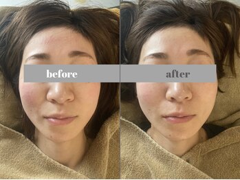 福多整体院/週一回を4回継続