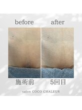 ココ シャルール(salon COCO CHALEUR)/Before　After