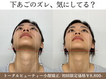 ナチュラルパーフェクトフェイス 新宿/小顔矯正/骨盤矯正/美脚矯正専門