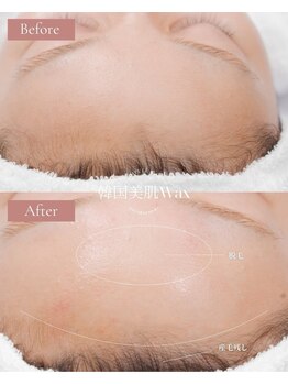 リル バイ アンドアール(Rire by and.R)/韓国美肌ワックス