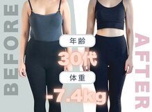 クラシック(CLASSIC)