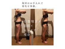 ブルーム(Bloom)の雰囲気（骨盤矯正×筋膜×痩身でカラダを整えてサイズダウンも目指せます）
