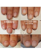 ニコプラス(NICO+)/パラジェルクリア補強