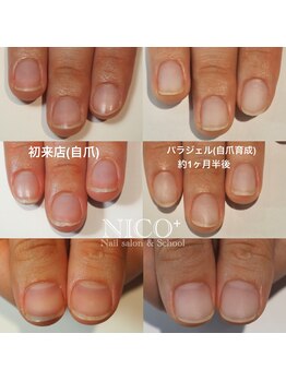 ニコプラス(NICO+)/パラジェルクリア補強