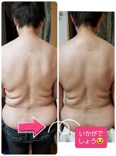 キレイとケンコウの応援サロン杉山/お背中の筋膜リリース