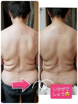 キレイとケンコウの応援サロン杉山/お背中の筋膜リリース