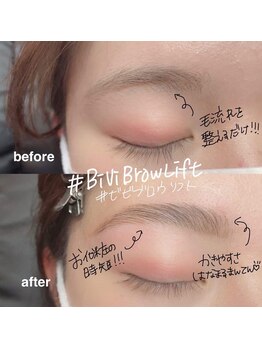 ボアップ(boappu)/美眉/眉毛/ビビブロウリフト/