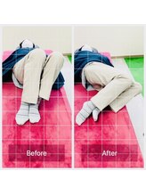 門前仲町イエティ鍼灸整骨院（旧：イエティ鍼灸整骨院）/椅子からの立ち上がりがつらい…