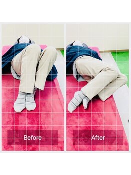 門前仲町イエティ鍼灸整骨院（旧：イエティ鍼灸整骨院）/椅子からの立ち上がりがつらい…