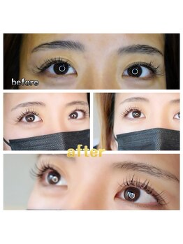 グリッターネイル(GLITTER NAILS)/アンドヘルシー