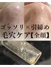 【黒ずみ/ザラつき】全顔毛穴特化フルコ-ス◆洗浄×プラズマ×高濃度ビタミン