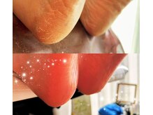 アベビー(Abeby)/手助けアイテム