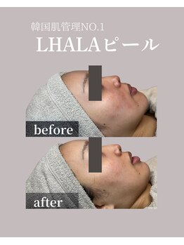 フォルディオ(FORDIO)/ララピール[札幌/円山]