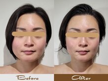 ハカハカ(HAKA HAKA)/ZERO美容リンパ頭蓋小顔矯正