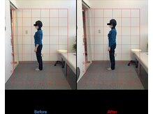 リード整骨院(LEAD整骨院)/姿勢改善、猫背、反り腰