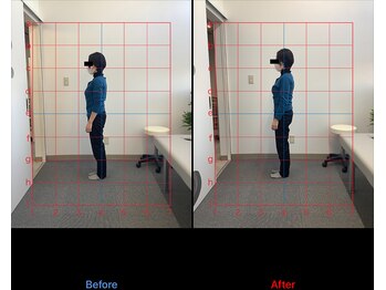 リード整骨院(LEAD整骨院)/姿勢改善、猫背、反り腰