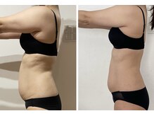 エタンセル(Etincelle)