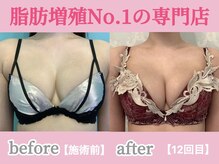 サラエクセレント 天王寺(SARA EXCELLENT)/短期集中コースもご用意！育乳