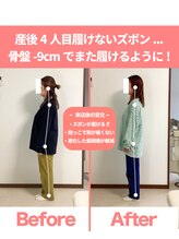 整体院ひなた 都城院/産後履けないズボンが履ける!!