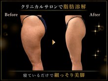 リオ(Rio)/【痩身/足/脂肪燃焼10ml】