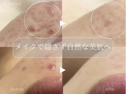 フェイシャルサロン ベルダ(BELDA)の写真