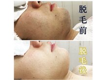 ベック(BECK)/メンズスタッフがマンツーマンで