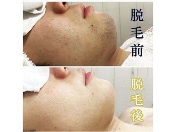 ベック(BECK)/メンズスタッフがマンツーマンで