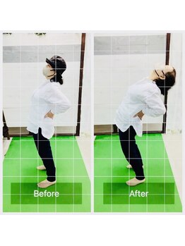 門前仲町イエティ鍼灸整骨院（旧：イエティ鍼灸整骨院）/ビフォーアフター♪