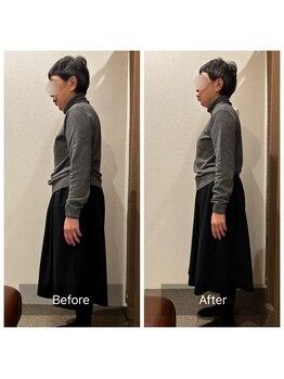 エスボディジャパン(S-BODY JAPAN)/腰痛改善例