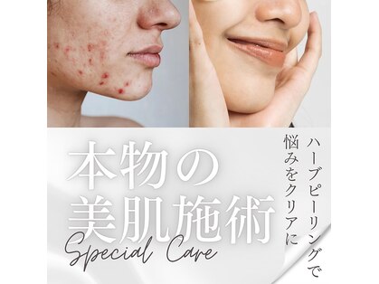 アジュール(a jour)の写真