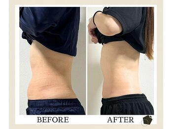 サンク(Cinq)/オイルマッサージを受けたい方