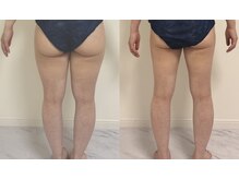 プリマルーチェ/プレミアム下半身プログラム